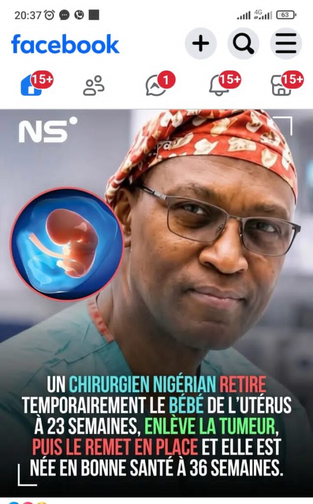 Le chirurgien nigérian Oluyinka Olutoye réalise une intervention fœtale révolutionnaire aux États-Unis